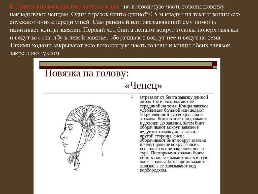 Повязка чепец. Повязка на волосистую часть головы. Повязка на волосистую часть головы чепец. Наложение повязки на волосистую часть головы. Повязка в виде Чепца на волосистую часть головы.