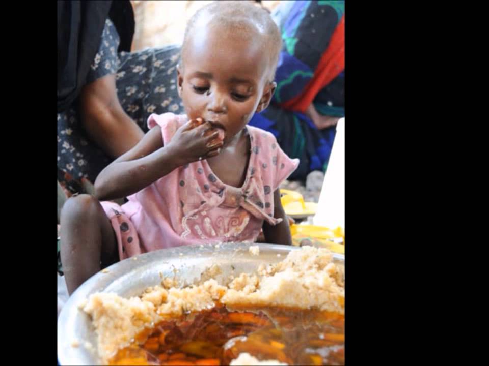Лицо голода. Голодающие африканские дети. Африканские дети Голодные. Бедные африканские дети.