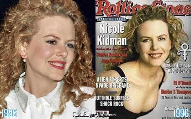 Nicole Kidman Fakes