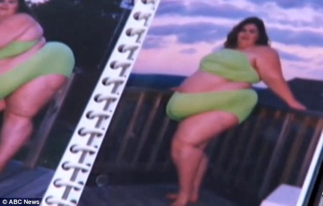 Trying to save: With gastric bypass surgery not covered by her insurance, the mother-of-one must raise the money herself